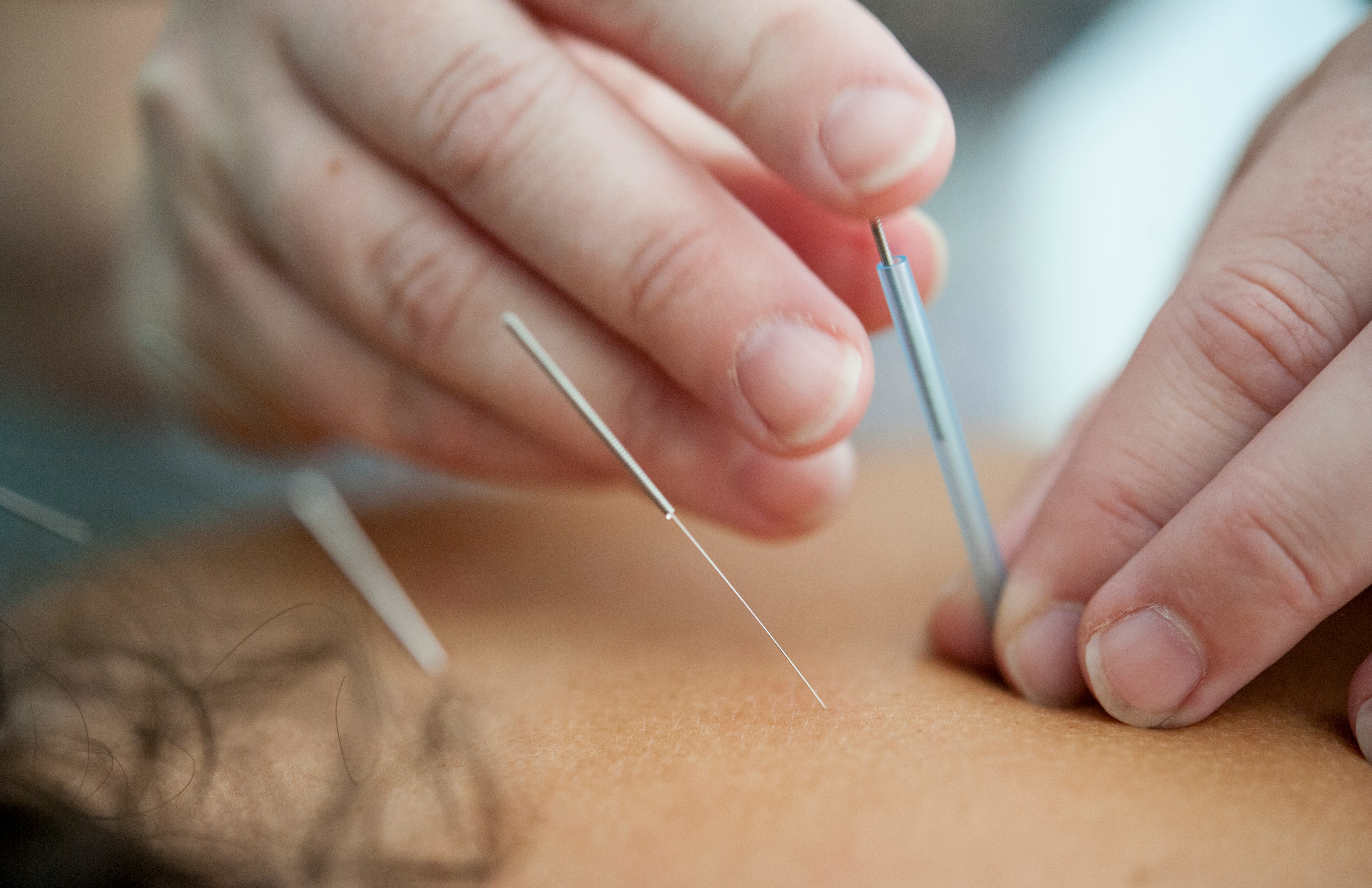 "Tratamento natural e integrativo para o alívio de dores persistentes, controle da ansiedade, estresse e insônia, equilíbrio hormonal